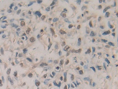 DAB staining on IHC-P; Samples:Human Liver Tissue)
