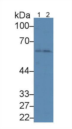 DAB staining on IHC-P; Samples: Human Colon Tissue;  Primary Ab: 20μg/ml Mouse Anti-Human ANGPT1 Antibody Second Ab: 2µg/mL HRP-Linked Caprine Anti-Mouse IgG Polyclonal Antibody