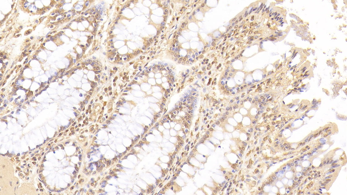Angiopoietin 1 (ANGPT1) Monoclonal Antibody - image 4