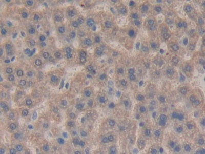DAB staining on IHC-P; Samples: Rat Liver Tissue)