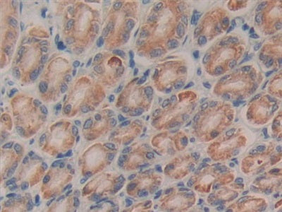 Connective Tissue Growth Factor (CTGF) Monoclonal Antibody - image 4