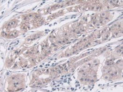 Insulin Like Growth Factor Binding Protein 4 (IGFBP4) Monoclonal Antibody - image 5
