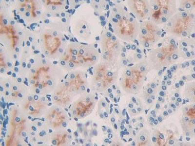 Figure. DAB staining on IHC-P; Samples: .Rat Adrenal Gland Tissue.