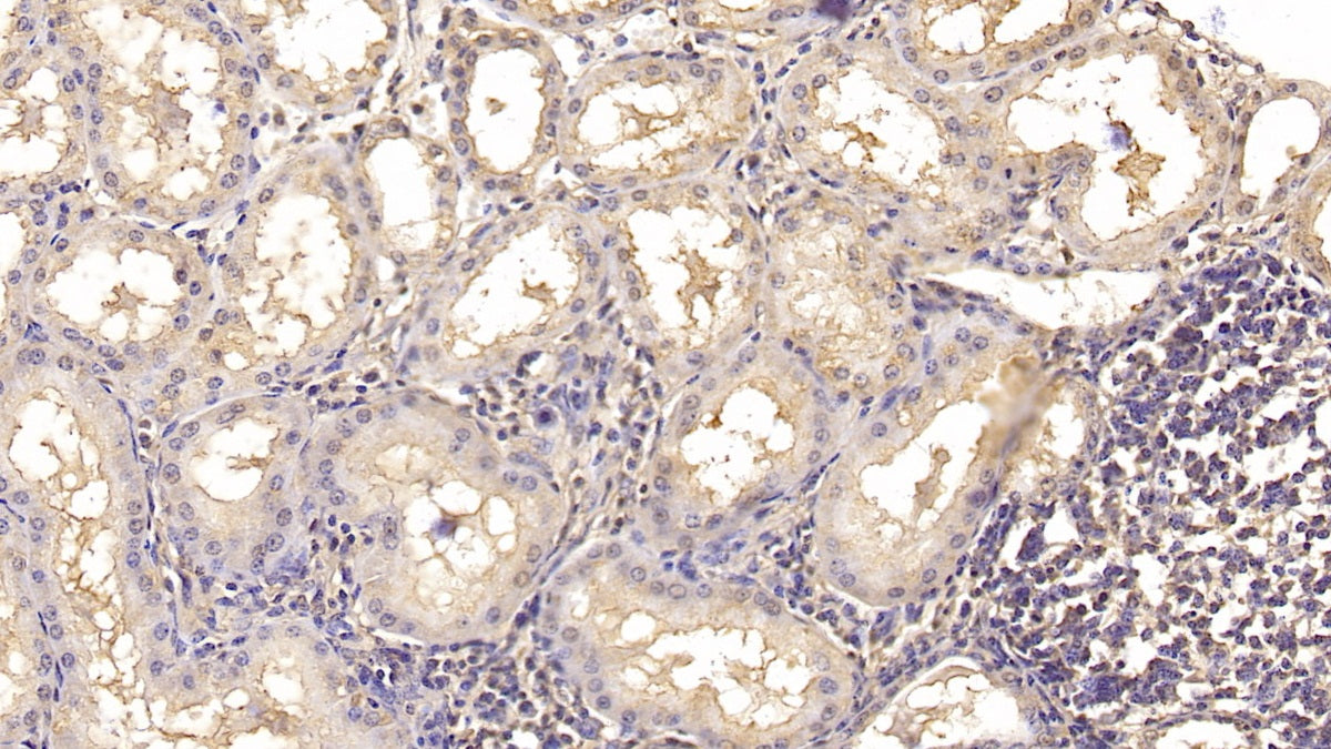 Interleukin 18 (IL18) Monoclonal Antibody - image 4