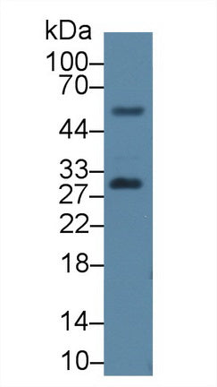 Western Blot; Sample: Recombinant protein.