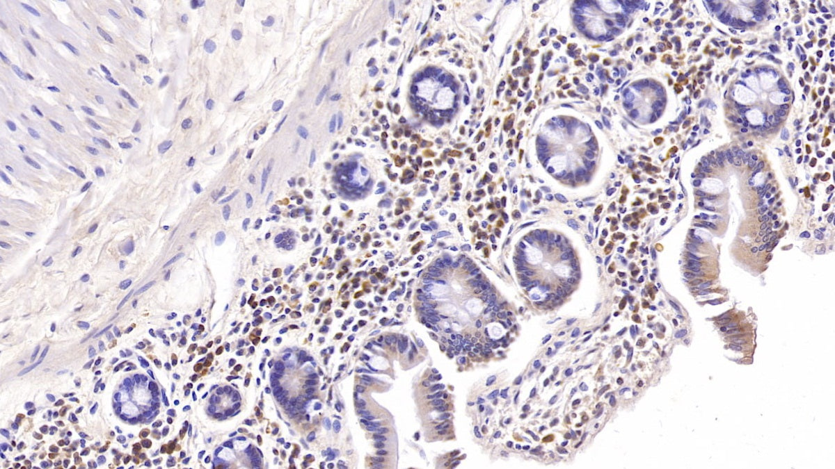 DAB staining on IHC-P; Samples: Rabbit Cardiac Muscle Tissue;  Primary Ab: 40µg/ml Mouse Anti-Rabbit IL6 Antibody Second Ab: 2µg/mL HRP-Linked Caprine Anti-Mouse IgG Polyclonal Antibody