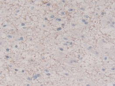 Interleukin 8 (IL8) Monoclonal Antibody - image 4