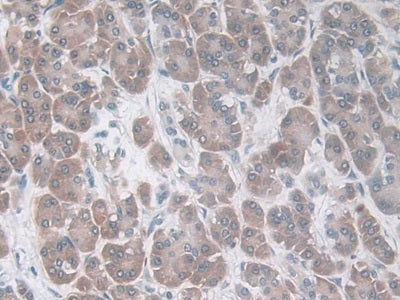 Macrophage Inflammatory Protein 3 Alpha (MIP3a) Monoclonal Antibody - image 4