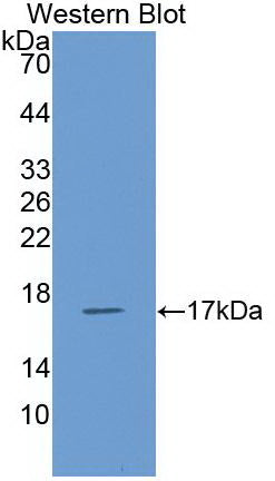 Regulated On Activation In Normal T-Cell Expressed And Secreted (RANTES) Monoclonal Antibody - image 2