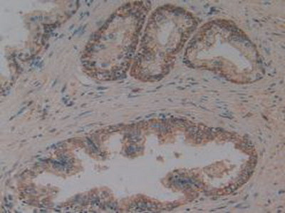 DAB staining on IHC-P;Samples:Human Brain Tissue)