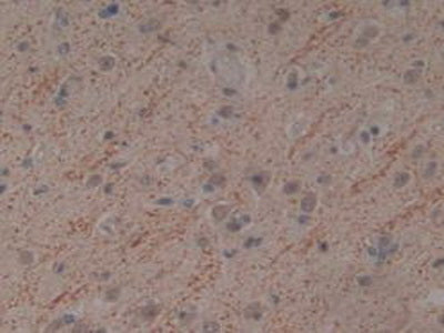 Tumor Necrosis Factor Related Apoptosis Inducing Ligand (TRAIL) Monoclonal Antibody - image 4