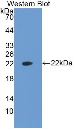 Vascular Endothelial Growth Factor A (VEGFA) Monoclonal Antibody - image 2