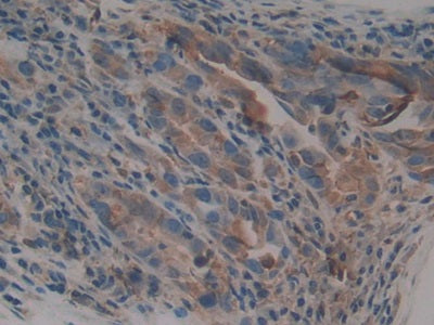 DAB staining on IHC-P; Samples: Human Stomach Tissue)