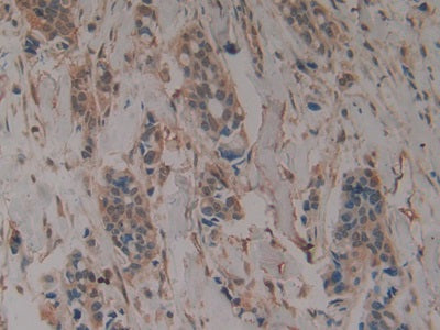 Galactosidase Alpha (GLa) Monoclonal Antibody - image 5