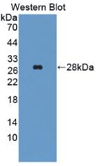 Western Blot; Sample: Lane1: Rat Liver lysate; Lane2: Rat Skeletal muscle lysate<br/>Primary Ab: 2μg/ml Mouse Anti-Human ALT Antibody<br/>Second Ab: 0.2µg/mL HRP-Linked Caprine Anti-Mouse IgG Polyclonal Antibody<br/>