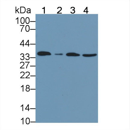 DAB staining on IHC-P; Samples: Human Kidney Tissue; Primary Ab: 40µg/ml Mouse Anti-Human ANXA5 Antibody Second Ab: 2µg/mL HRP-Linked Caprine Anti-Mouse IgG Polyclonal Antibody