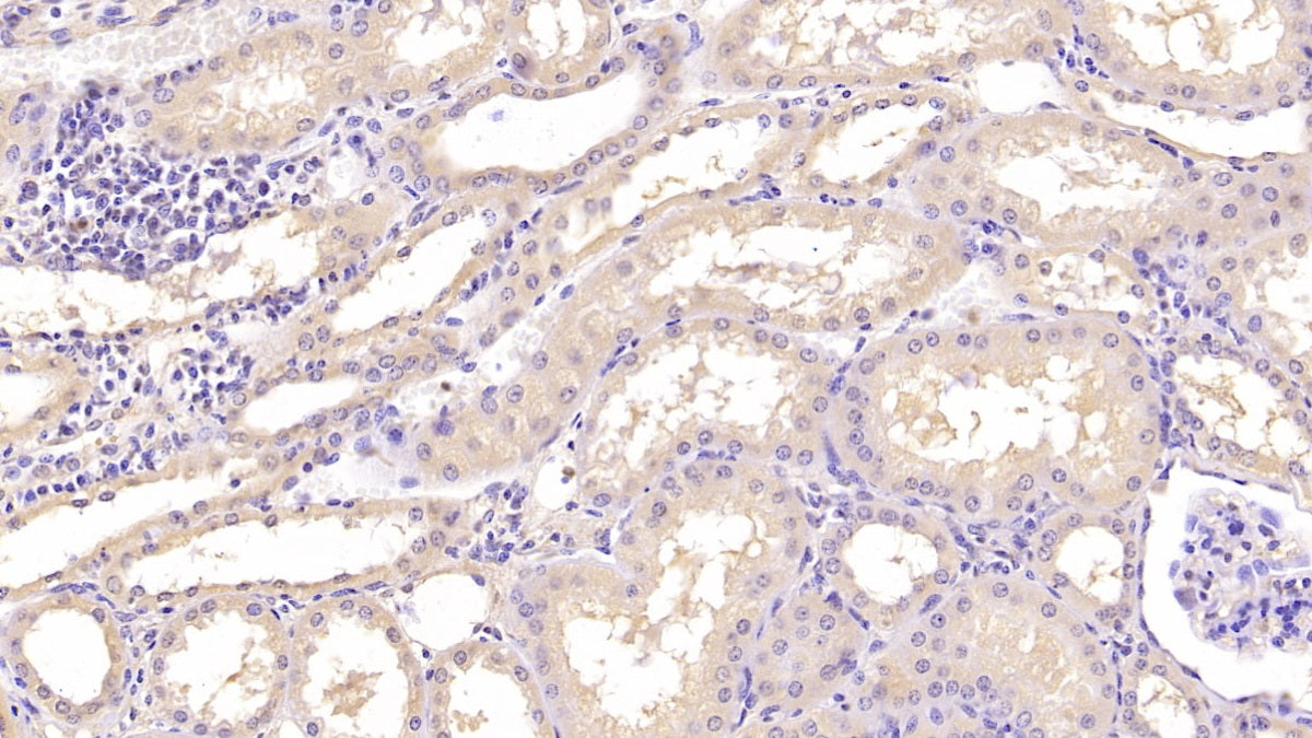 DAB staining on IHC-P; Samples: Human Cerebrum Tissue; Primary Ab: 40µg/ml Mouse Anti-Human ANXA5 Antibody Second Ab: 2µg/mL HRP-Linked Caprine Anti-Mouse IgG Polyclonal Antibody