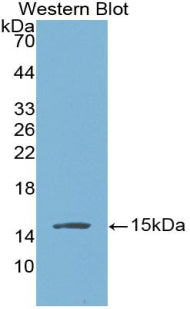 Brain Natriuretic Peptide (BNP) Monoclonal Antibody - image 2