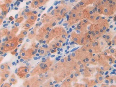 DAB staining on IHC-P; Samples: Human Stomach Tissue)