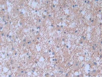 Brain Natriuretic Peptide (BNP) Monoclonal Antibody - image 4