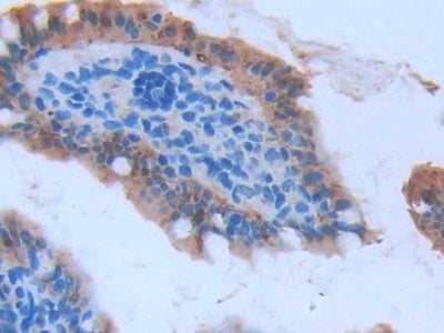 DAB staining on IHC-P; Samples: Rat Small intestine Tissue