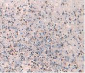 Amylin (Amylin) Monoclonal Antibody - image 3