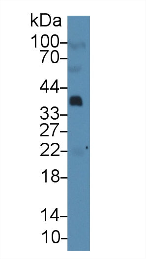 Western Blot; Sample: Rat Thymus lysate; ; Primary Ab: 6µg/mL Mouse Anti-Rat PTHrP Antibody; Second Ab: 0.2µg/mL HRP-Linked Caprine Anti-Mouse IgG Polyclonal Antibody;