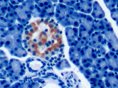 Parathyroid Hormone Related Protein (PTHrP) Monoclonal Antibody - image 4