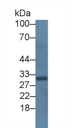 Receptor Activator Of Nuclear Factor Kappa B Ligand (RANkL) Monoclonal Antibody - image 3