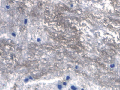 Receptor Activator Of Nuclear Factor Kappa B Ligand (RANkL) Monoclonal Antibody - image 5