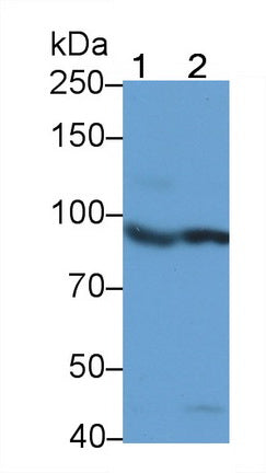 Insulin Receptor (Anti-INSR) Monoclonal Antibody - image 2