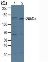 Amyloid Beta Peptide 1-42 (Ab1-42) Monoclonal Antibody - image 2