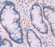 Amyloid Beta Peptide 1-42 (Ab1-42) Monoclonal Antibody - image 4