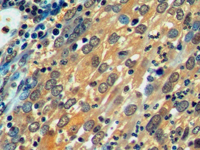 Heat Shock 70kDa Protein 1 Like Protein (HSPA1L) Monoclonal Antibody - image 5