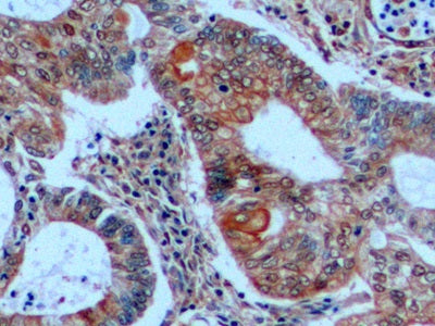 Cytokeratin 18 (CK18) Monoclonal Antibody - image 5