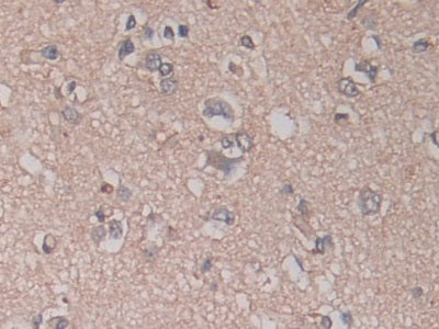 A Disintegrin And Metalloprotease 17 (ADAM17) Monoclonal Antibody - image 5