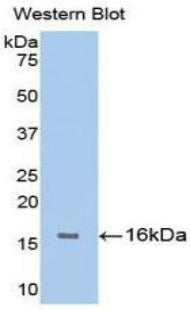Fibroblast Growth Factor Receptor 1 (FGFR1) Monoclonal Antibody - image 2