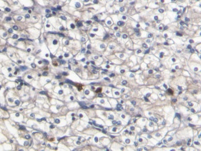 S100 Calcium Binding Protein A8 (S100A8) Monoclonal Antibody - image 4