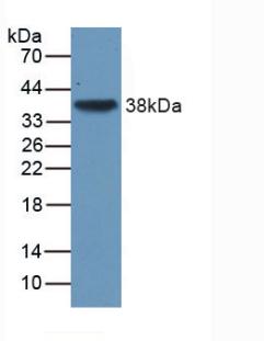 DAB staining on IHC-P; Samples: Human Cerebrum Tissue;  Primary Ab: 30µg/ml Mouse Anti-Human TGFb3 A