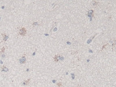 Figure. DAB staining on IHC-P;<br/>Samples: Human Stomach Tissue.