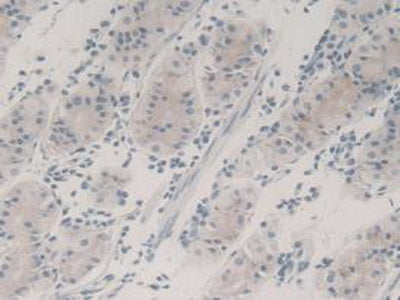 Transforming Growth Factor Beta 3 (TGFb3) Monoclonal Antibody - image 5