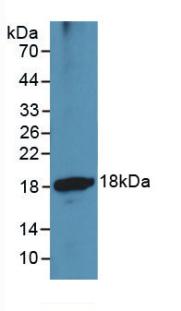 A Disintegrin And Metalloproteinase With Thrombospondin 1 (ADAMTS1) Monoclonal Antibody - image 2