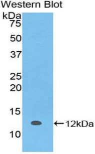S100 Calcium Binding Protein A5 (S100A5) Monoclonal Antibody - image 2