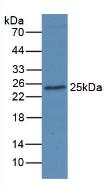 Western Blot; Sample: Recombinant AGR2, Human.