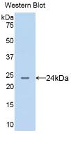 DAB staining on IHC-P; Samples: Human Stomach Tissue; Primary Ab: 30µg/ml Mouse Anti-Human AGR2 Antibody Second Ab: 2µg/mL HRP-Linked Caprine Anti-Mouse IgG Polyclonal Antibody