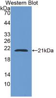 Adenylyl Cyclase Associated Protein 2 (CAP2) Monoclonal Antibody - image 2