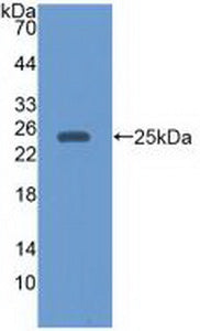 Epstein Barr Virus Induced Protein 3 (EBI3) Monoclonal Antibody - image 2