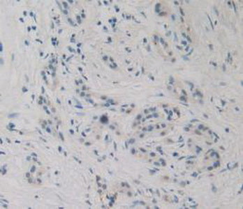 Epstein Barr Virus Induced Protein 3 (EBI3) Monoclonal Antibody - image 4