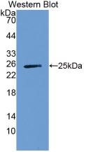 DAB staining on IHC-P; Samples: Human Liver Tissue;  Primary Ab: 30µg/ml Mouse Anti-Human a1BG Antibody Second Ab: 2µg/mL HRP-Linked Caprine Anti-Mouse IgG Polyclonal Antibody