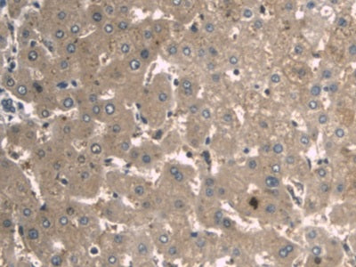 Figure. DAB staining on IHC-P; Samples: Human Liver Tissue.